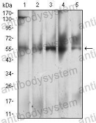 Western blot for Anti-CD299/CLEC4M Antibody (R3W44) ?>