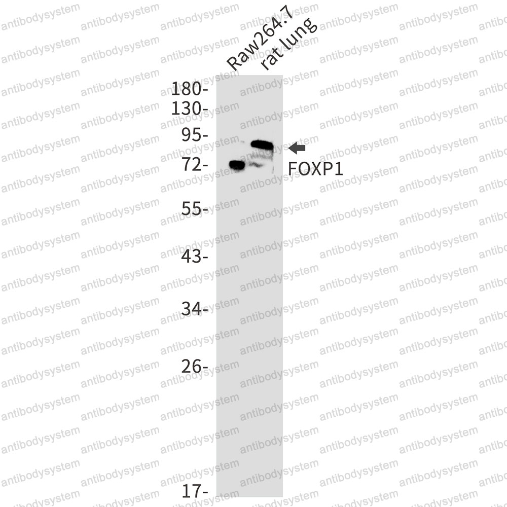 Anti-FOXP1 Antibody (R2K18)