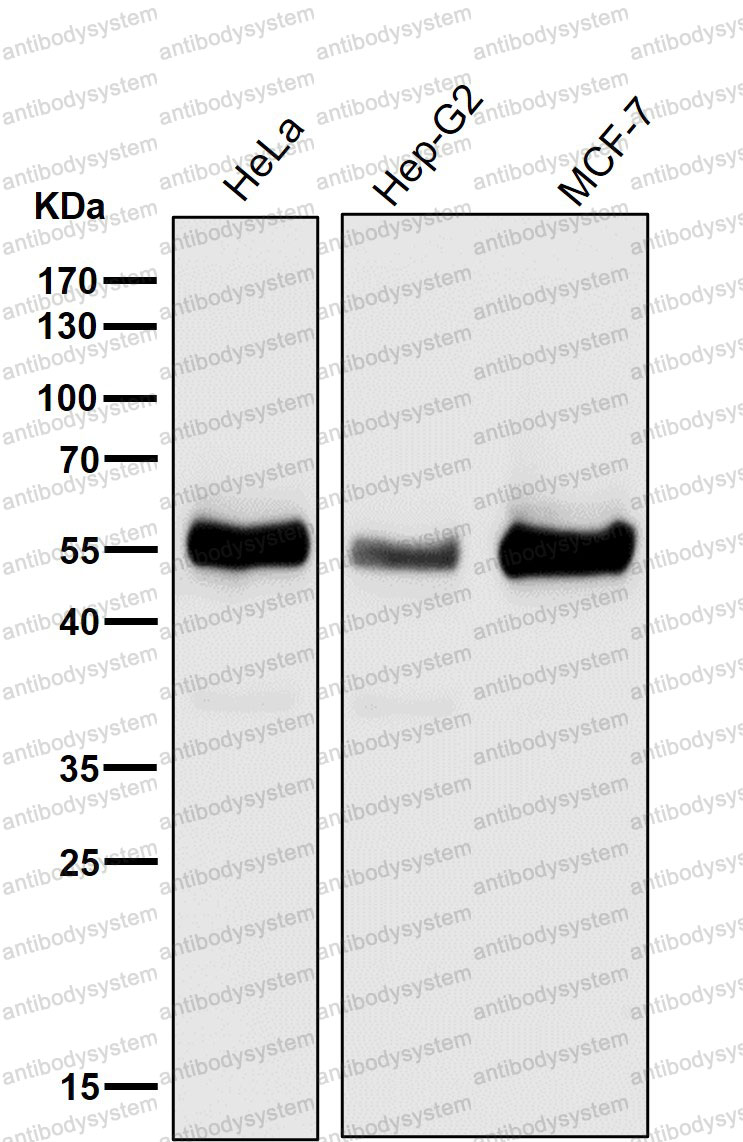 Anti-TXNIP Antibody (R2K19)