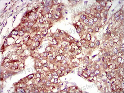 Immunohistochemical for Anti-MAP1LC3A Antibody (R3W49) ?>