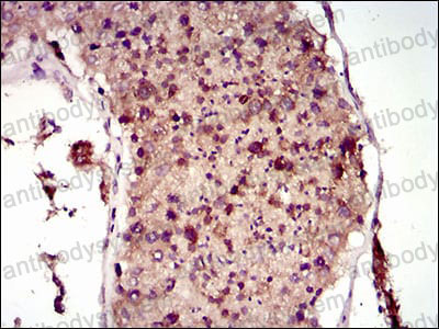 Immunohistochemical for Anti-MAP1LC3A Antibody (R3W49) ?>