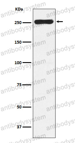 Anti-WNK1 Antibody (R2K22)