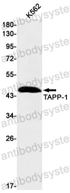 Anti-PLEKHA1 Antibody (R2K26)