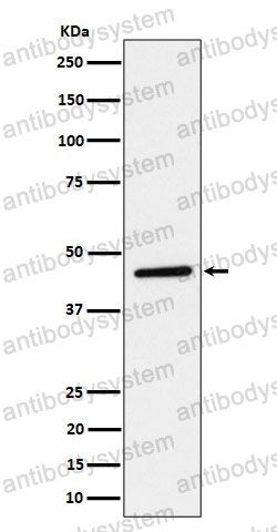 Anti-PLEKHA1 Antibody (R2K25)