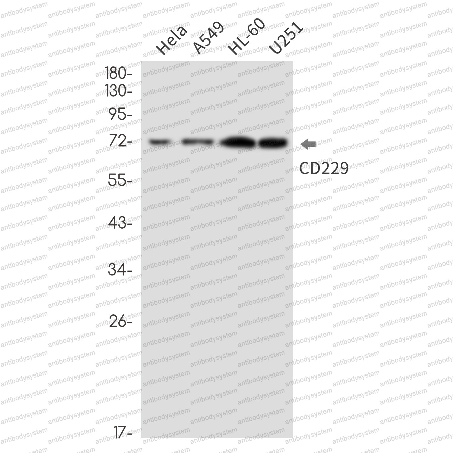 Anti-CD229/LY9 Antibody (R2K27)