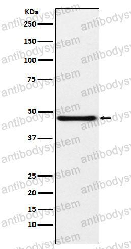 Anti-NPHS2 Antibody (R2K28)