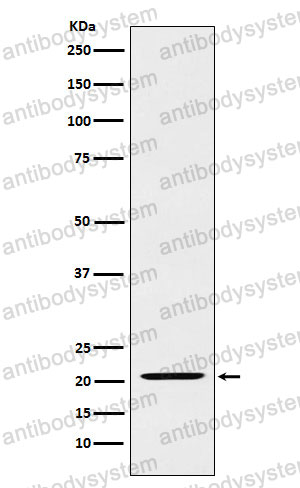 Anti-IL23A/IL-23p19 Antibody (R2K29)