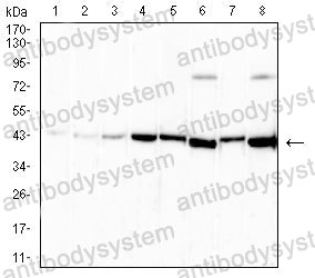 Western blot for Anti-NGB Antibody (R3W77) ?>