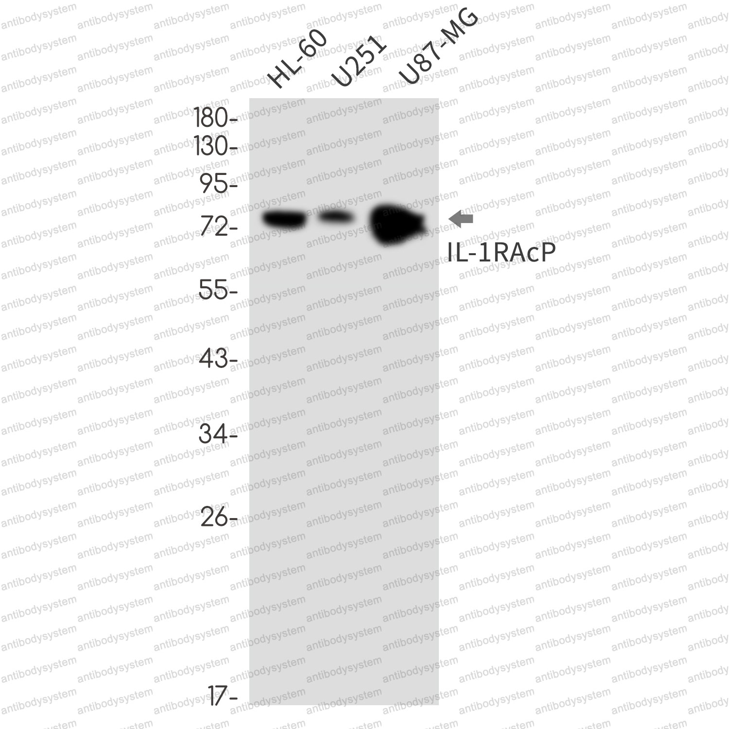 Anti-IL1RAP Antibody (R2K30)