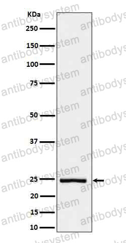 Anti-IL26/AK155 Antibody (R2K31)
