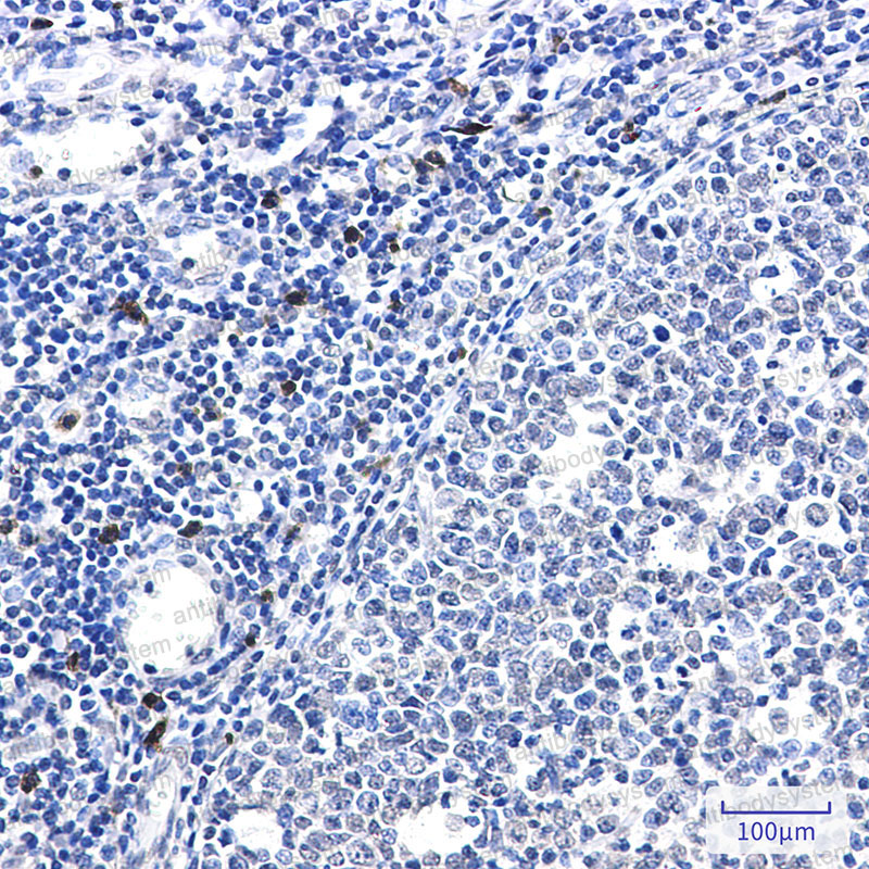 Anti-IL26/AK155 Antibody (R2K32)