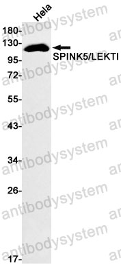 Anti-SPINK5 Antibody (R2K34)