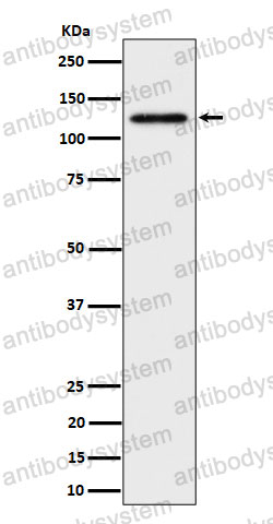 Anti-SPINK5/LEKTI Antibody (R2K33)