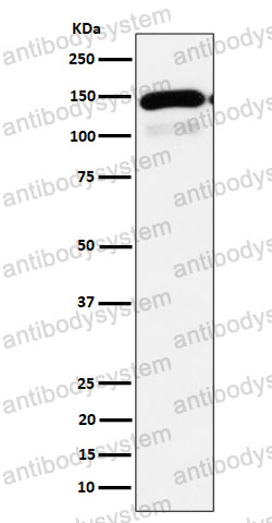 Anti-PLCB1 Antibody (R2K35)