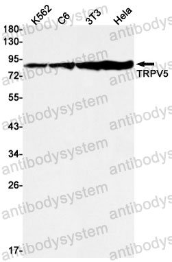 Anti-TRPV5 Antibody (R2K38)