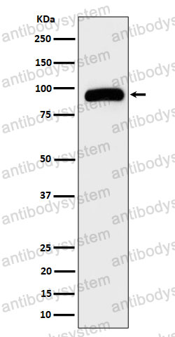 Anti-TRPV5 Antibody (R2K37)