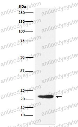 Anti-GDF3 Antibody (R2K40)