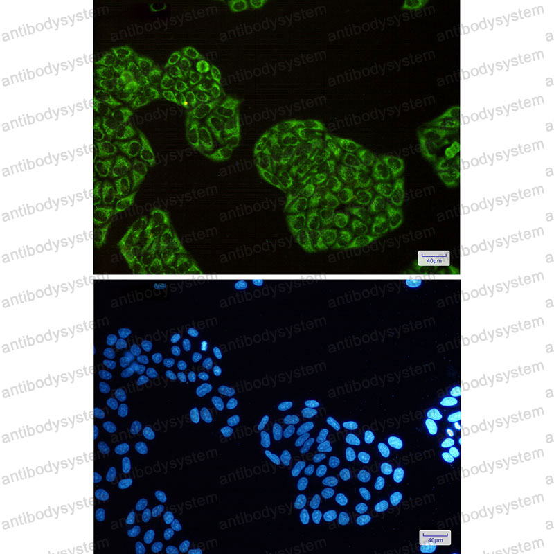Anti-DISC1 Antibody (R2K43)