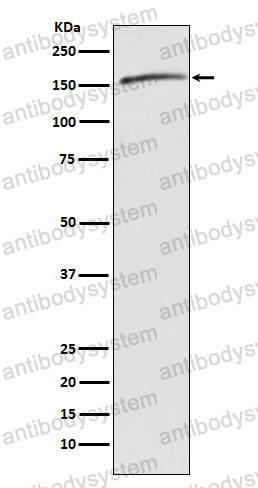 Anti-DROSHA Antibody (R2K44)