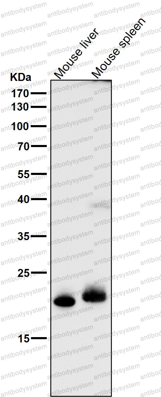 Anti-FGF21 Antibody (R2K45)