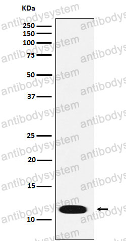 Anti-CTNNBIP1 Antibody (R2K46)
