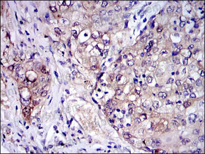 Immunohistochemical for Anti-IRAK4 Antibody (R3W99) ?>