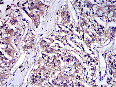 Immunohistochemical for Anti-IRAK4 Antibody (R3W99) ?>
