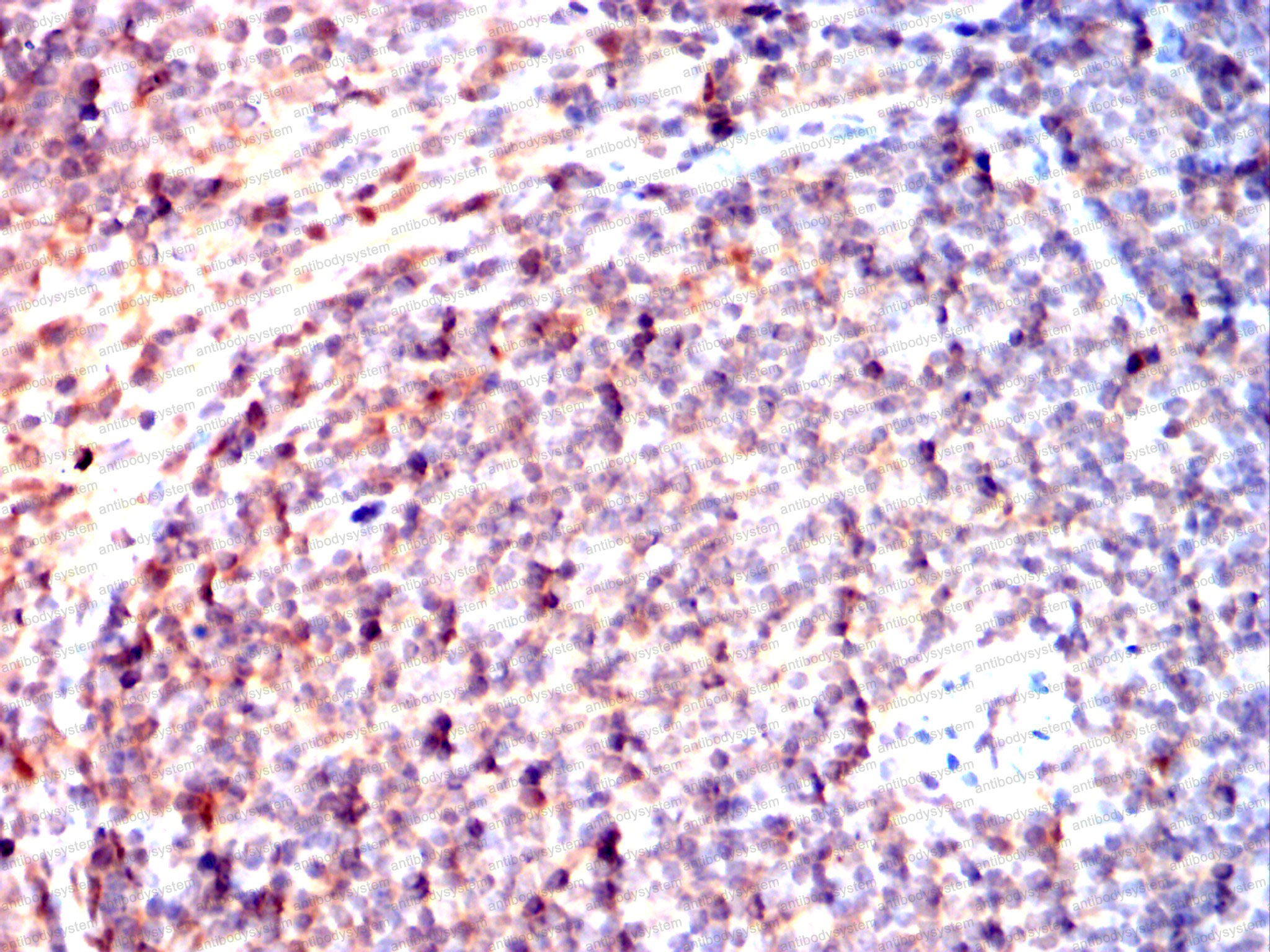 Immunohistochemical for Anti-IRAK4 Antibody (R3W99) ?>