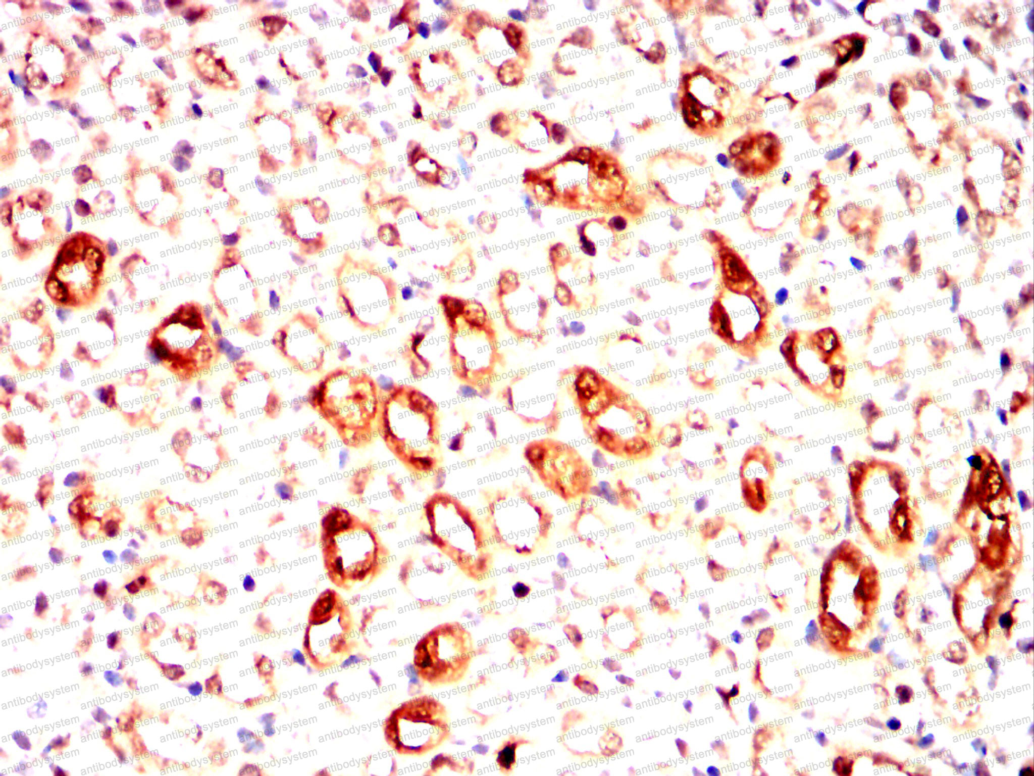 Immunohistochemical for Anti-IRAK4 Antibody (R3W99) ?>