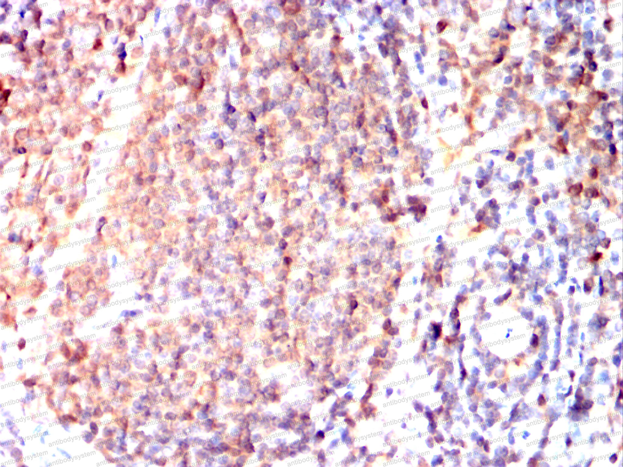 Immunohistochemical for Anti-IRAK4 Antibody (R3W99) ?>