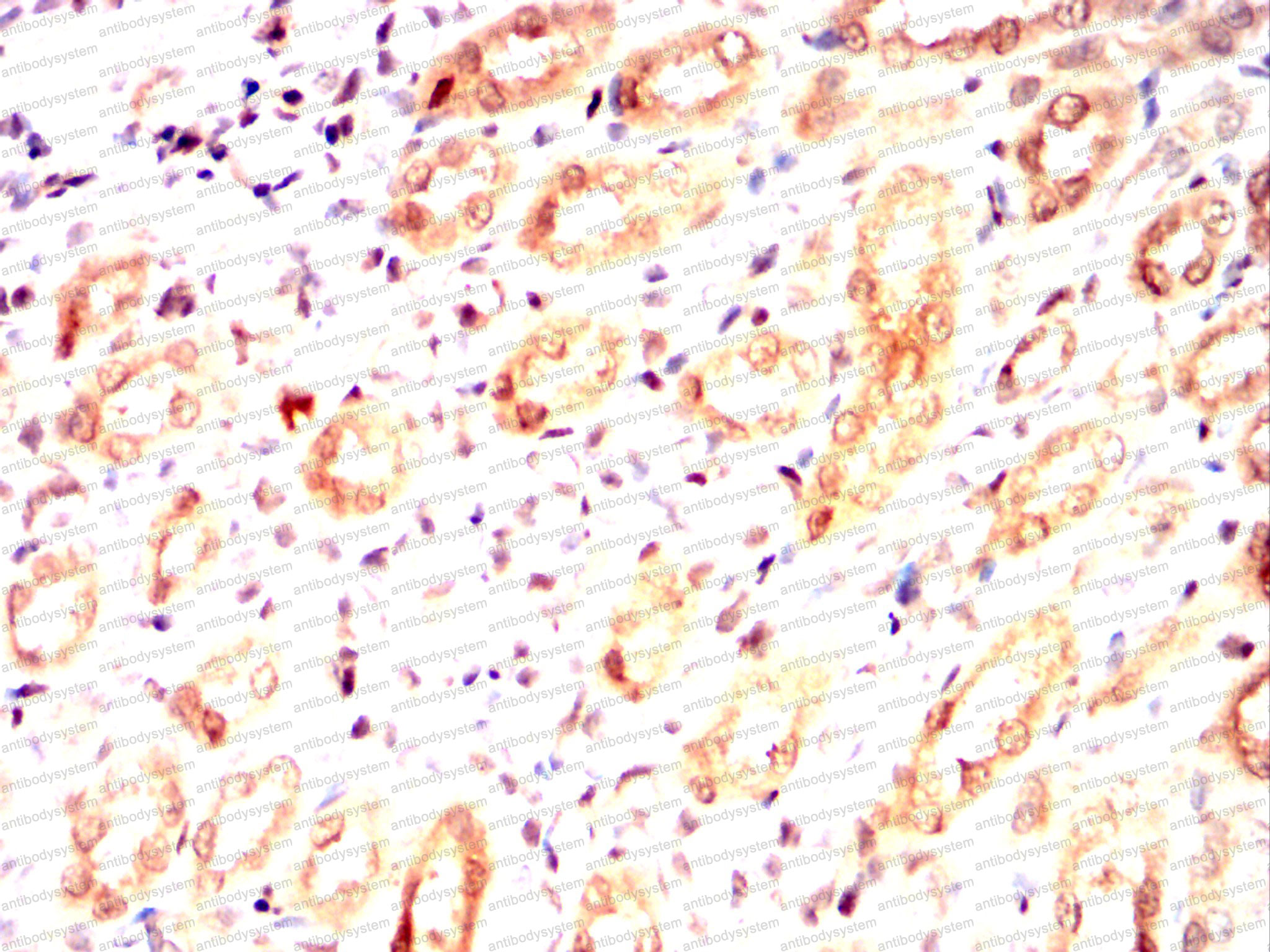 Immunohistochemical for Anti-IRAK4 Antibody (R3W99) ?>
