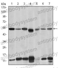 Western blot for Anti-IRAK4 Antibody (R3W99) ?>