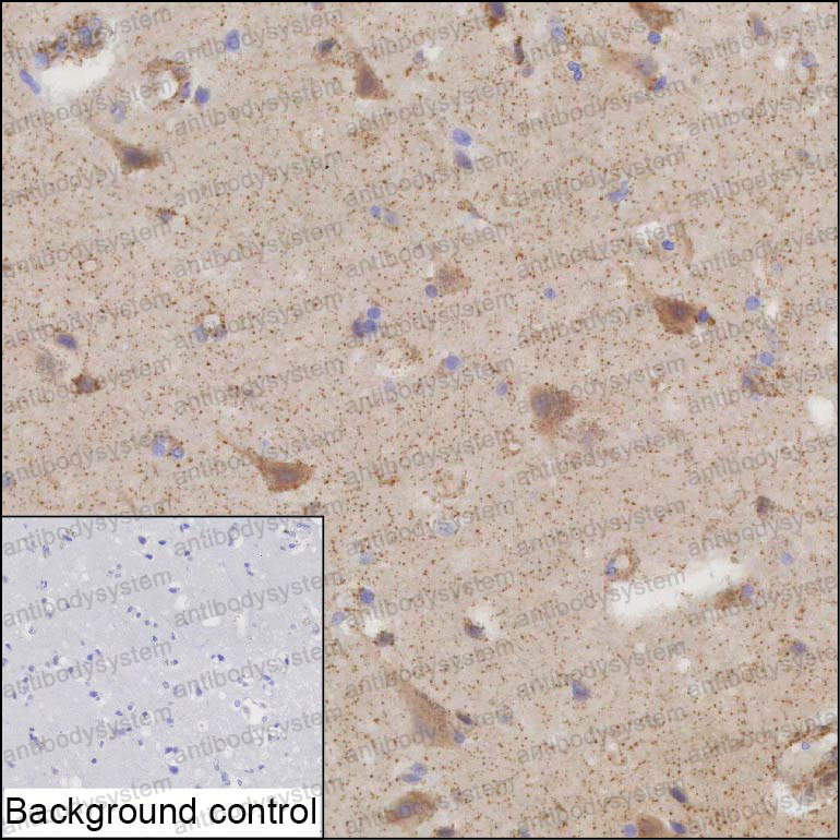 Immunohistochemical for Anti-PDP1 Antibody (R3X11) ?>