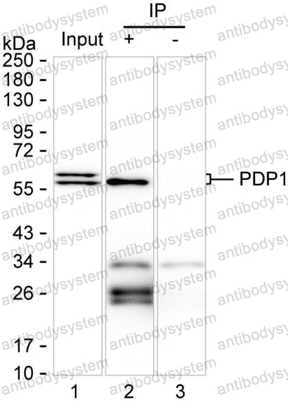 Immunoprecipitation for Anti-PDP1 Antibody (R3X12) ?>