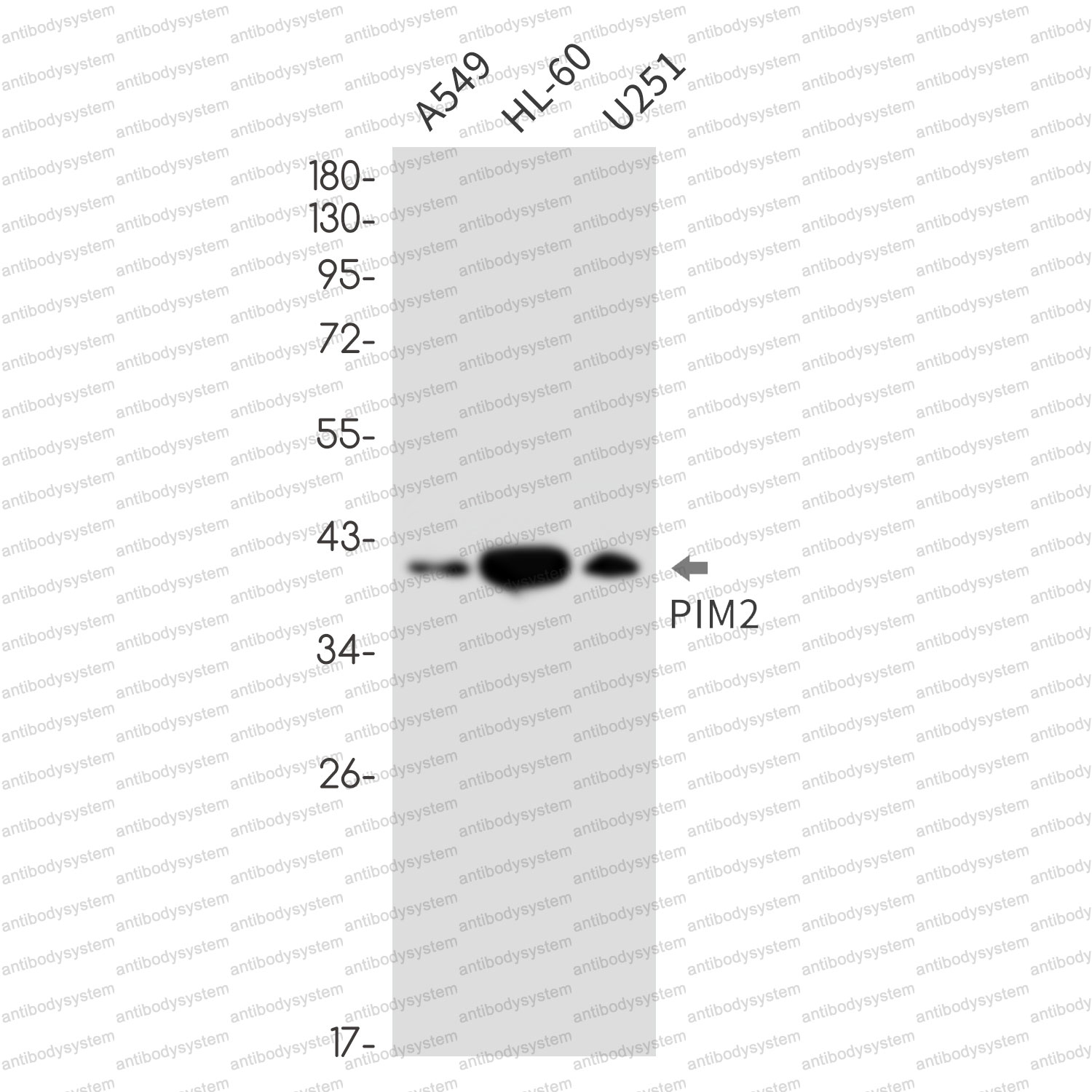 Anti-PIM2 Antibody (R2K57)