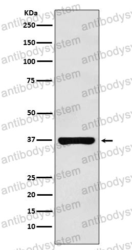 Anti-PIM2 Antibody (R2K55)