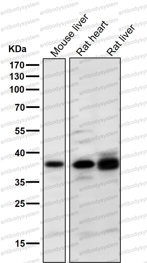 Anti-PIM2 Antibody (R2K56)