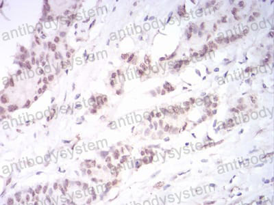 Immunohistochemical for Anti-DNMT3B Antibody (R3X24) ?>