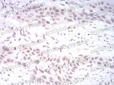 Immunohistochemical for Anti-DNMT3B Antibody (R3X24) ?>