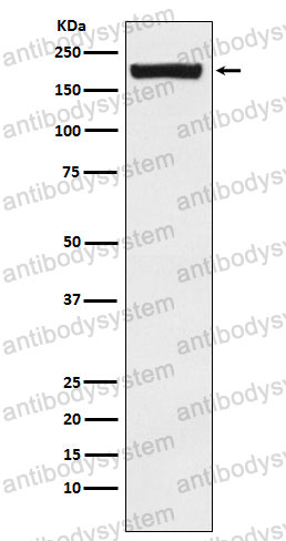 Anti-CD280/MRC2 Antibody (R2K61)