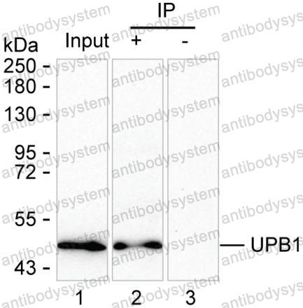 Immunoprecipitation for Anti-UPB1 Antibody (R3X31) ?>