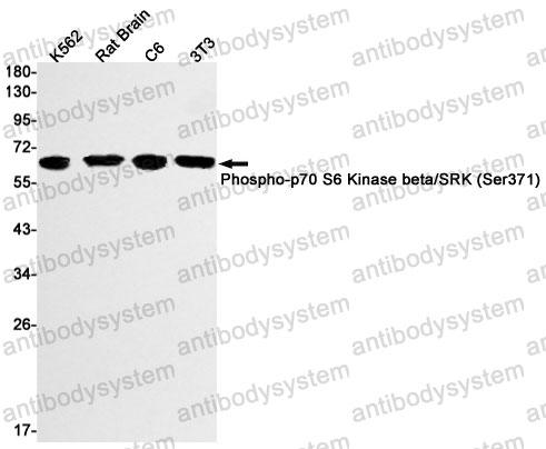 Anti-Phospho-RPS6KB2S6K2 (Ser371) Antibody (R2K66)