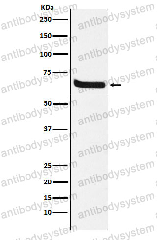 Anti-KL Antibody (R2K70)