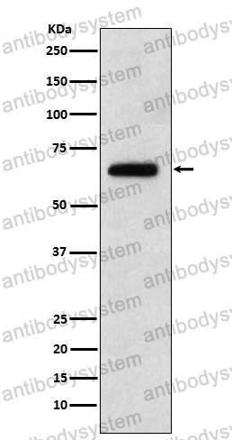 Anti-EBF1 Antibody (R2K74)