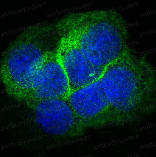 Anti-COL17A1 Antibody (R1C32)