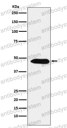 Anti-EBP1/PA2G4 Antibody (R2K93)
