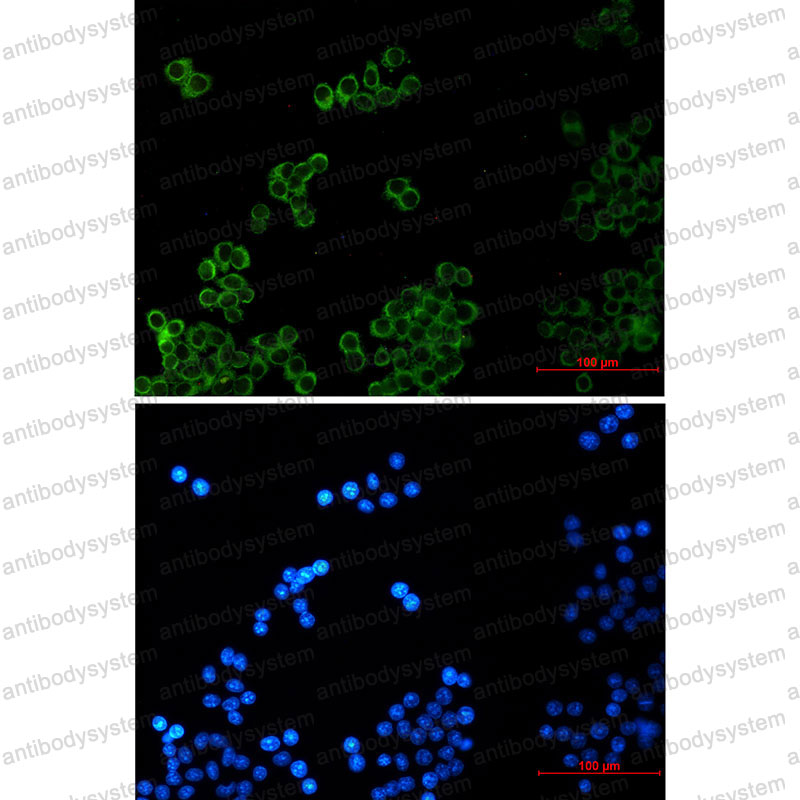 Anti-PLAA Antibody (R2L03)