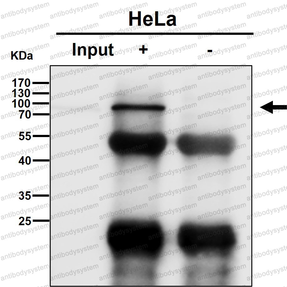 Anti-PLAA Antibody (R2L02)