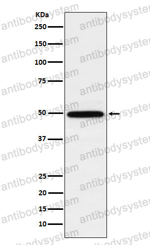 Anti-RUVBL1 Antibody (R2L04)
