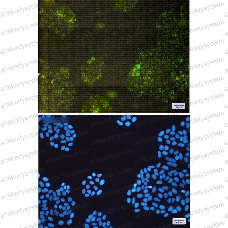 Anti-GSTK1 Antibody (R2L06)